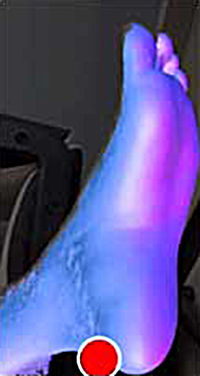 scan of a foot